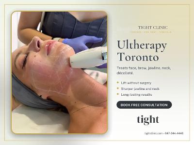 Ultherapy Toronto - HIFU Non-Surgical Facelift - Tight Clinic